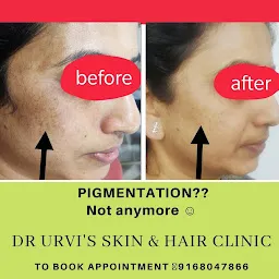 Dr. Urvi's Skin, Hair & Laser clinic