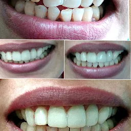 Dr. Vikas Garg Dental Clinic & Orthodontic Maxillofacial Centre.