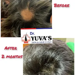 Dr YUVA'S SKIN & HAIR CLINIC