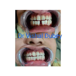 Dubey Dental Clinic ( Dr Vishal Dubey)