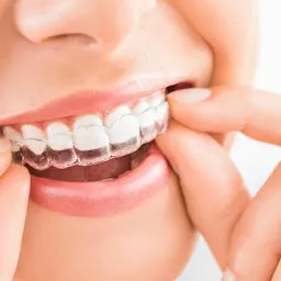 Expert Dental Care - Dental Clinic in Chanda Nagar and Madinaguda