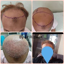 Facethetic Clinic - Maxillofacial & Hair Transplant Surgeon