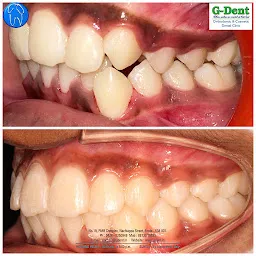 G-Dent Dental Clinic