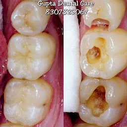 Gupta Dental Care