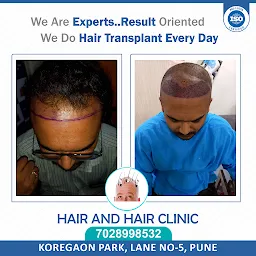 Hair And Hair Clinic Hair Transplant Clinic