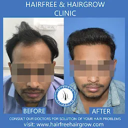 Hairfree And Hairgrow Clinic