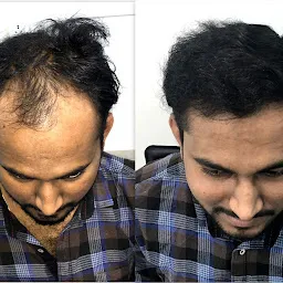 Hairfree Hairgrow Hair Transplant Clinic || Hair Transplant In Hyderabad