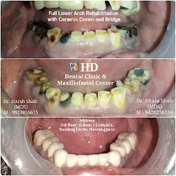 HD Dental Clinic & Maxillofacial Center ( Implant - RCT - Cosmetic)