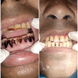 HiTech Dental Clinic