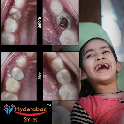 Hyderabad Smiles