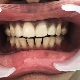 i dental