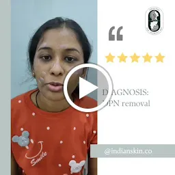 Indian Skin & Hair Transplant Centre, Slimming centre, Hijama & Cupping