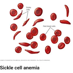 INDRA-GIRI BLOOD/BONE MARROW TRANSPLANT CLINIC