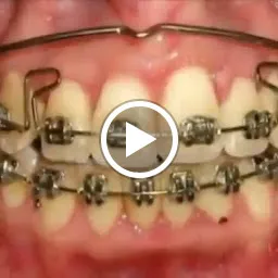 Institute of Advanced Dentistry | Dentist in Juhu Vile Parle
