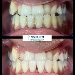 ISHANI'S DENTAL CLINIC & IMPLANT CENTER