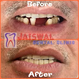 JAISWAL DENTAL CLINIC | NAGPUR