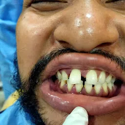 Kindle Dental | Best Dental Clinic in Moran, Assam