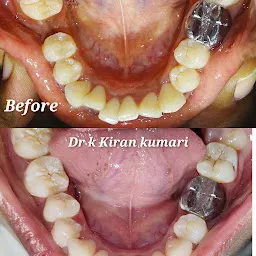 Life Kare Dental Hospital & Implant Centre vanasthalipuram Hyderabad