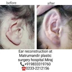 Matrumandir Plastic Surgery Hospital