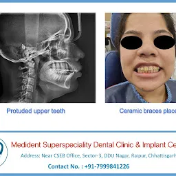 MEDIDENT SUPERSPECIALITY DENTAL CLINIC AND IMPLANT CENTER