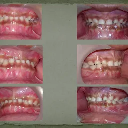 Mission Smile Orthodontics Invisalign Dental Clinic