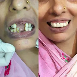 MMD Dental