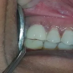 Muskaan Dental Clinic