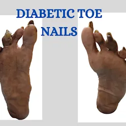 Nashik Diabetic