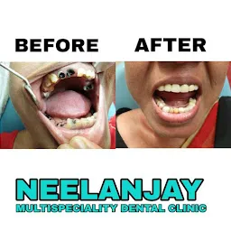 Neelanjay Multispeciality Dental Clinic
