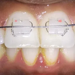 Nikhil Smile Multispeciality Dental Clinic Dr.Rajesh.M.V BDS. MDS Orthodontics
