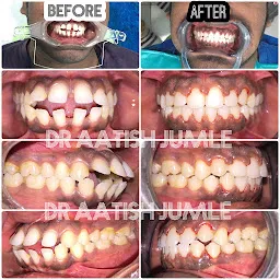 Om Dental Clinic - Trusted Dentist & Dental Clinic