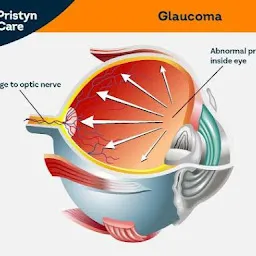 Ophthalmologist - Eye Surgeon | Cataract | Lasik & ICL | Retinal Treatments | Squint