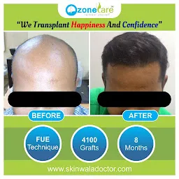 Ozone Care