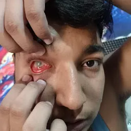 Parkash Eye Care