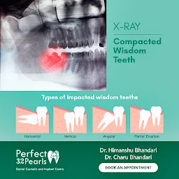 Perfect 32 Pearls Dental Clinic & Implant Centre -Dental Capping Clinic/RCT Single Sitting/Implant/Dental Clinic in Pathankot