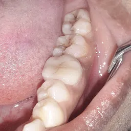 Periocare Dental Clinic (Gum Treatment Centre)