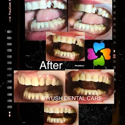 PIYUSH DENTAL CARE | Best Dental Clinic in Allahabad | Teeth Whitening | Cosmetic Dentist in Allahabad | Top Dental Clinic