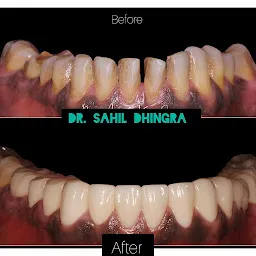 Prime Dental & Root Canal treatment Center - Dr. Sahil Dhingra