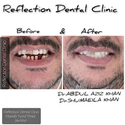 Reflection Dental Clinic
