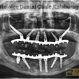 Rejoice Dental & Implant Clinic