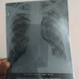 Roshni Digital X-ray and Pathology Test Centre