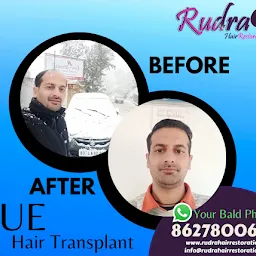 Rudra Hair Restoration