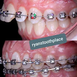 Ryans Tooth Place Dental Hospital