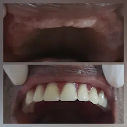 Sadhvi Dental Care