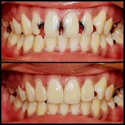 Sahi dental clinic-Best Dentist in Jalandhar/Endodontist/Prosthodontist/Orthodontist/Cosmetic Dentist/RCT in Jalandhar