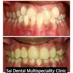 Sai Multispeciality Dental Clinic - Dr Sarika khade palaskar.