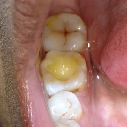 Samadhan Orthodontic and Dental Care