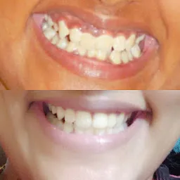 Samrat Dental Care - Confident Smile for Your Family