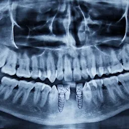 Sanjay Dental Clinic 'Maxillofacial Trauma, Implant and Orthodontic Centre (National Award Winner)