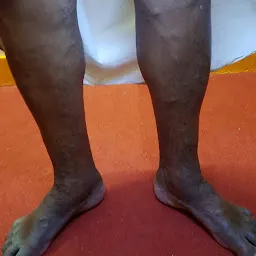 Sarada clinic ( LASER VARICOSE VEIN CENTRE, KERALA)